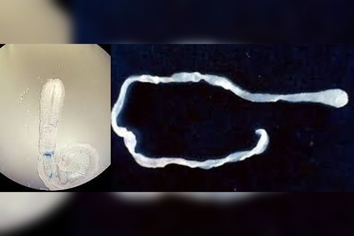 引用:アメリカ疾病予防管理センター(CDC)