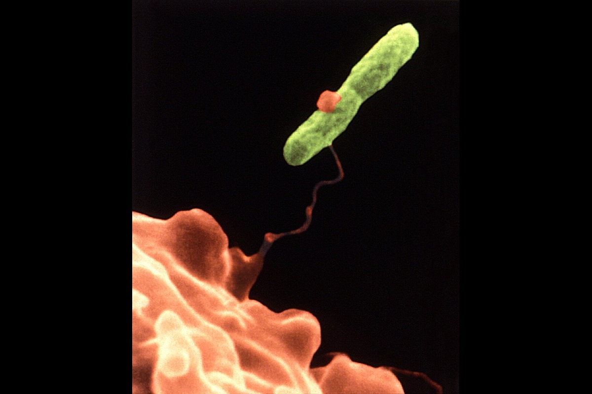引用：米疾病予防管理センター（CDC）