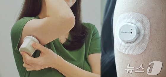 연속혈당측정기 부착방법을 설명한 홈페이지 사진(왼쪽)과 실제 팔에 부착한 모습 © 뉴스1