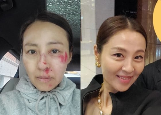 사진=전혜진 인스타그램