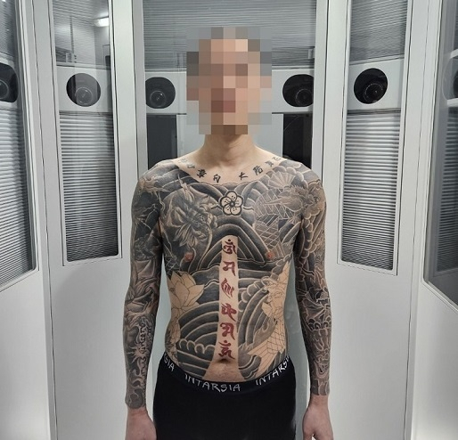“여유증 수술 받았어요”… 허위 수술로 보험금 가로챈 일단 174명 덜미
