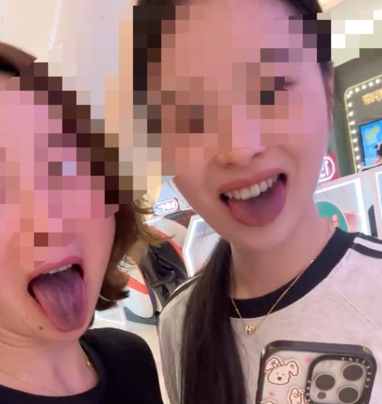 최근 중국의 한 훠궈식당에서 식사를 한 후 혀가 까맣게 됐다는 중국 여성. 사진=대완신문 캡처