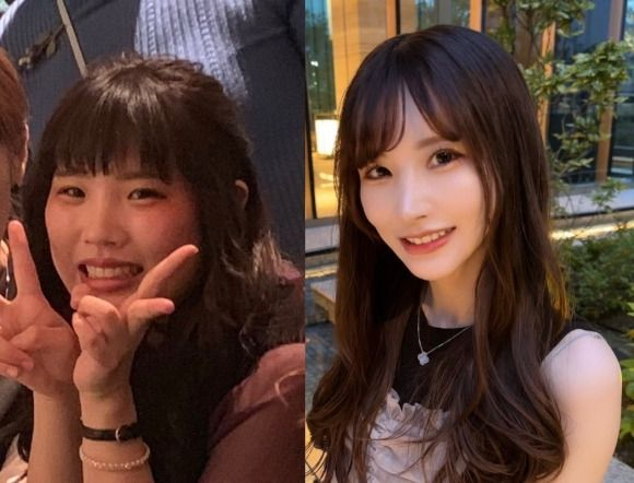 '못생겨서 차였어요' 현금 1억7000만원 싸들고 와 '풀성형'한 日 여성 결국…