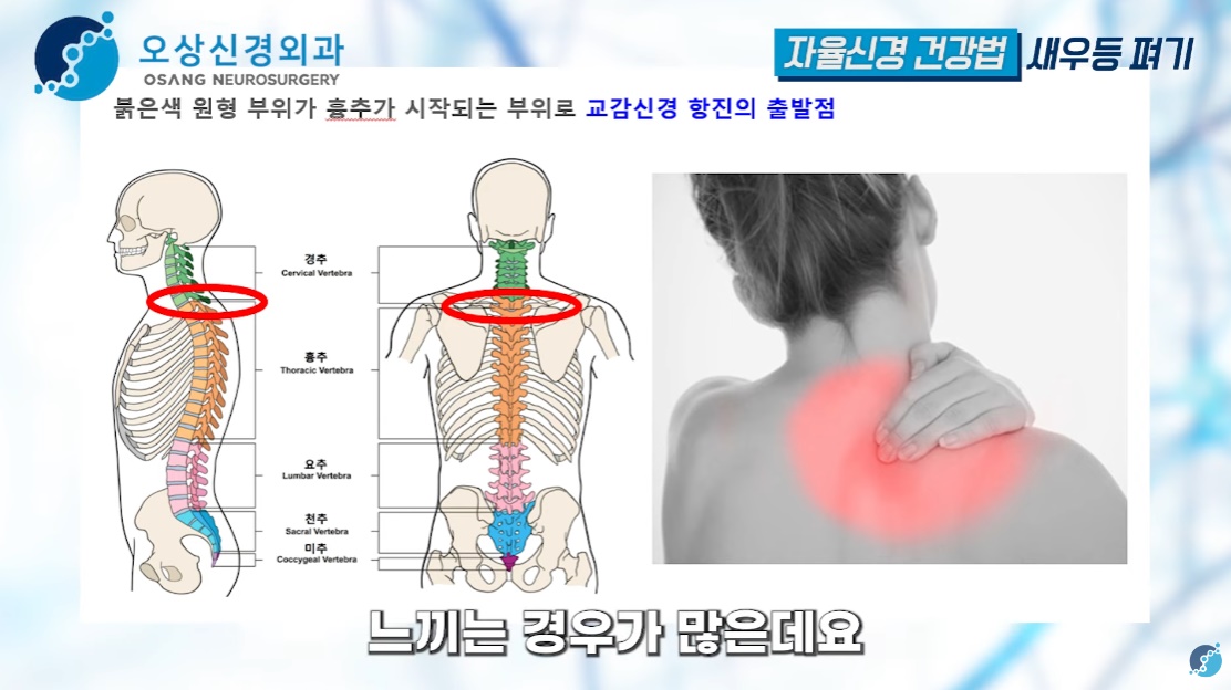 목과 등, 어깨 부위가 뻐근한 이유는, 이 부위가 교감신경의 뿌리이기 때문이다 / 출처 : 오상신경외과 유튜브 채널