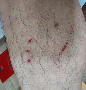 '의전이 이게 뭐야?'…공무원 멱살 잡고 정강이 걷어찬 농협조합장 결국