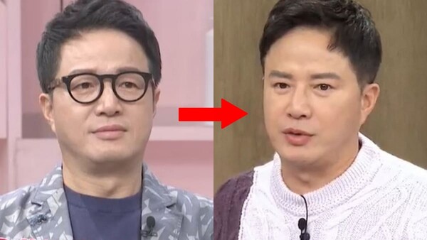 조영구 성형 전후 모습 [사진=MBN '속풀이쇼 동치미']