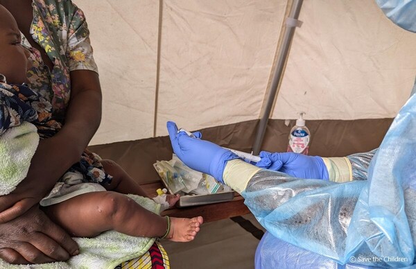 ▲엠폭스에 감염된 생후 5개월 된 아기 [사진제공=세이브더칠드런]