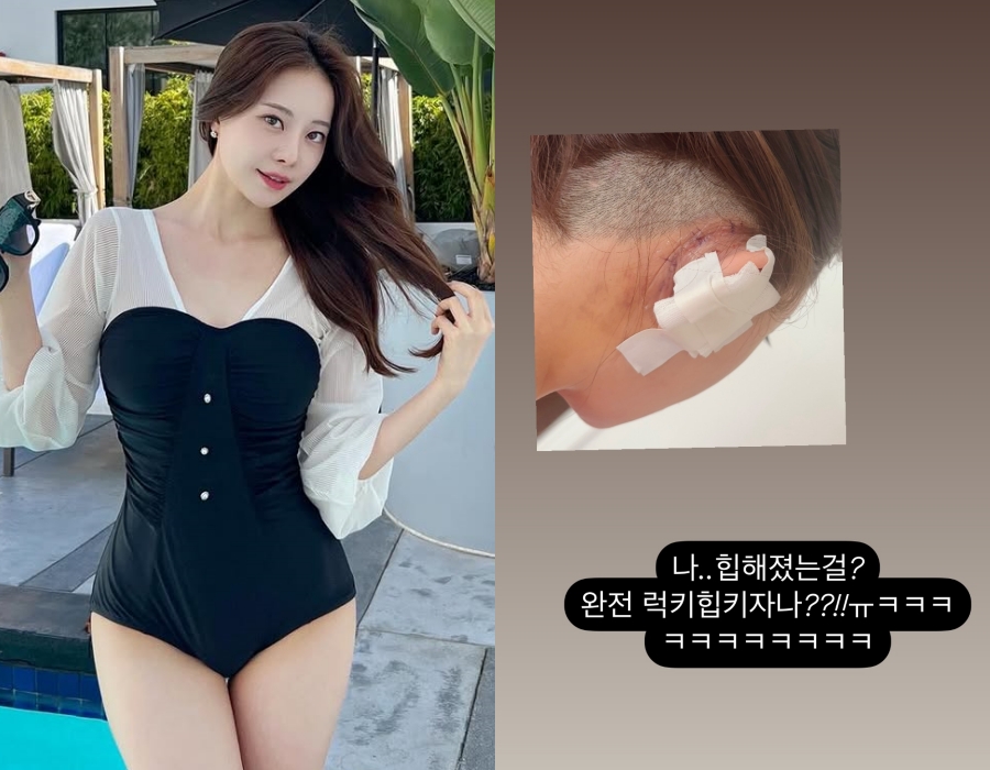 사진 : 아옳이 인스타그램