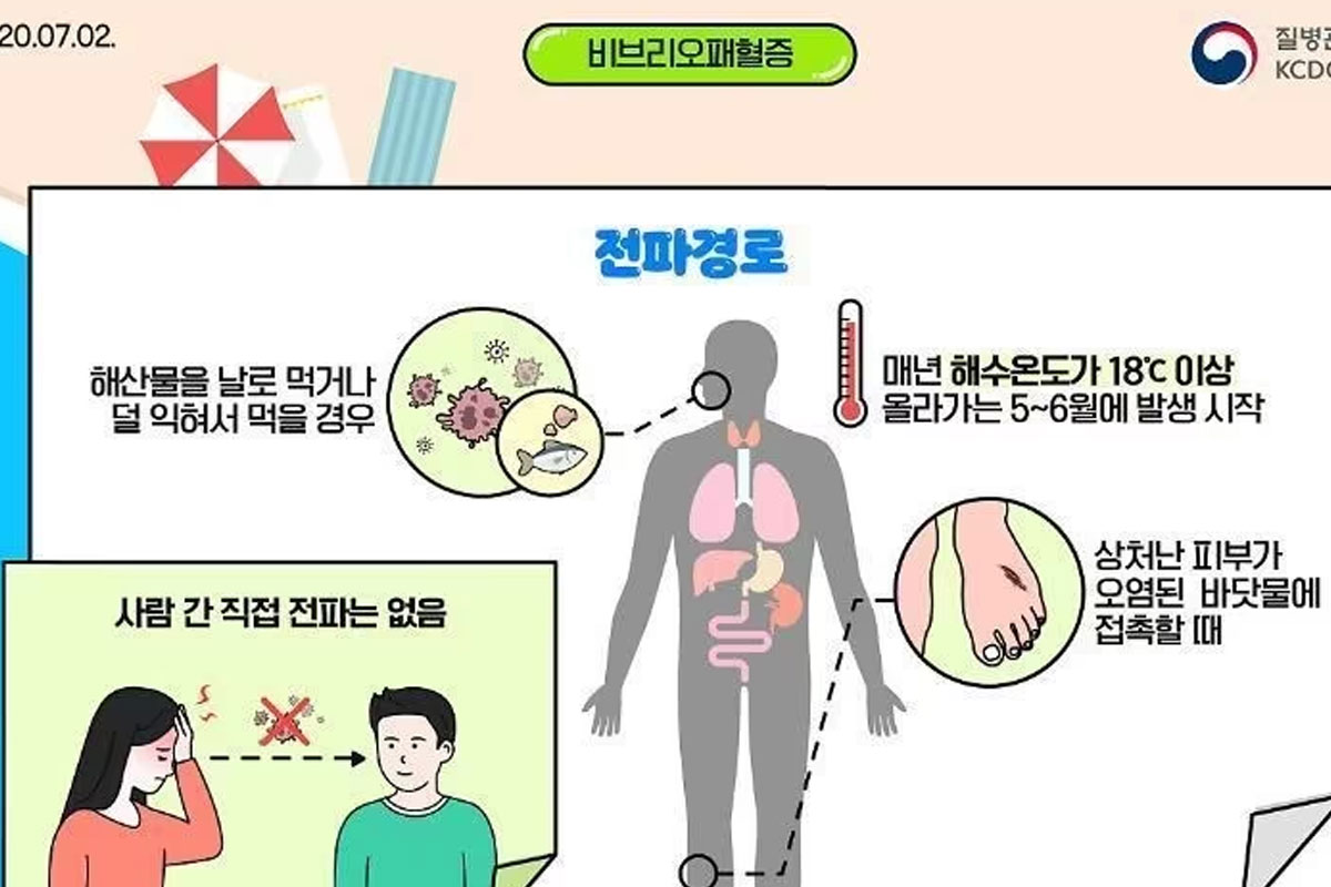 출처 : 질병관리본부