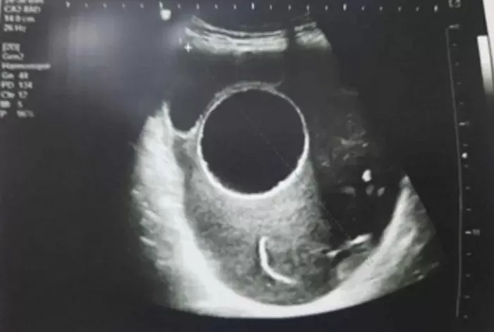 引用：Open Journal of Clinical and Medical Case Reports