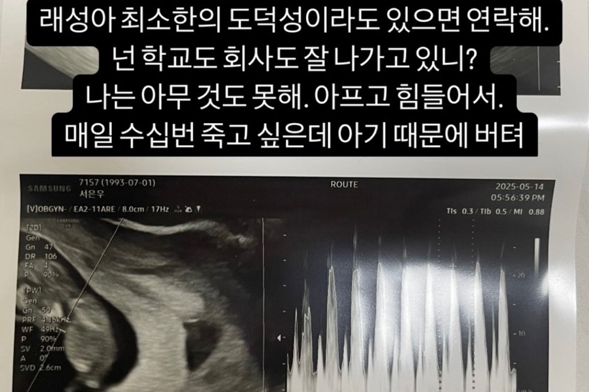 출처 : 서민재 인스타그램