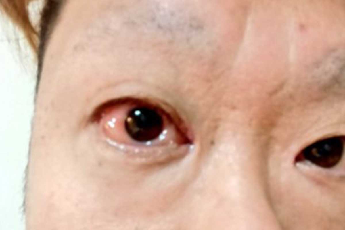 출처 : 타쿠야 SNS