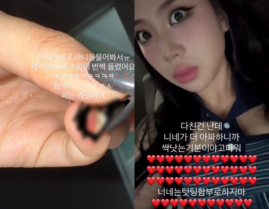 사진 : 이영지 인스타그램