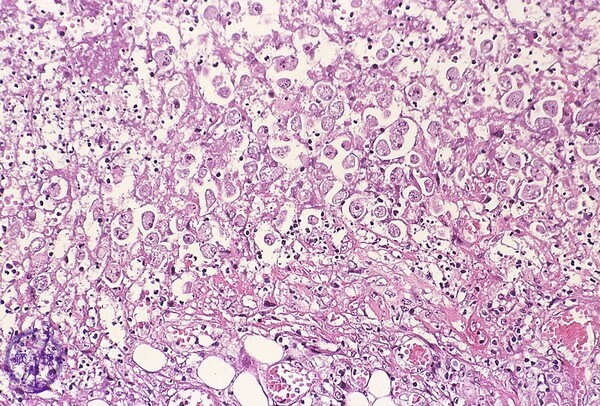 pathology