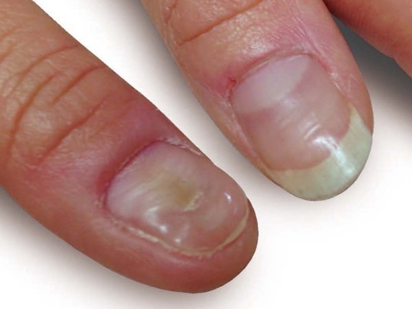nailclinique