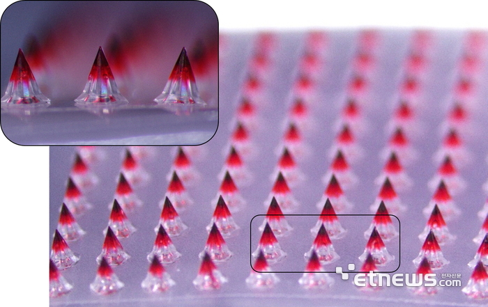 대웅테라퓨틱스가 개발한 마이크로니들 패치의 약물층을 시각적으로 표현하기 위해 색소를 첨가하고 6.7배 확대 촬영한 모습