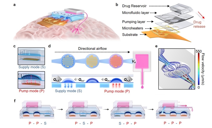 뇌 삽입형 무선 마이크로펌프 기반 정밀 약물 전달 시스템 개략도