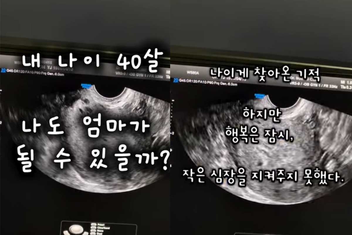 출처 : 오초희 SNS