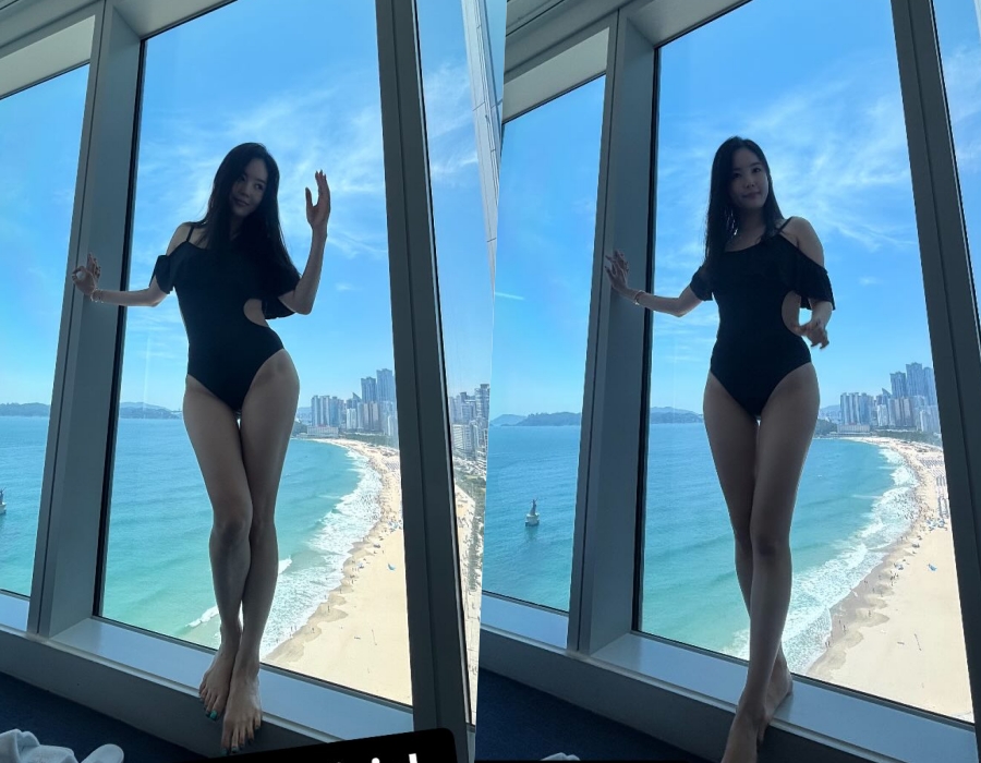 사진 : 장영란 인스타그램
