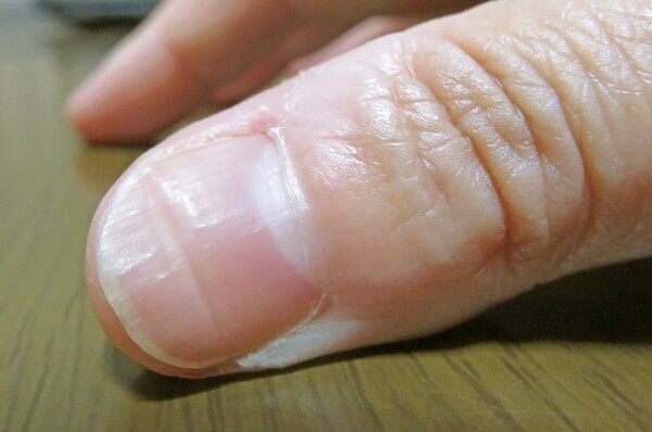 nailcare-lili
