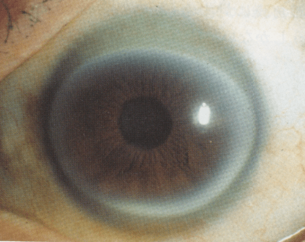 kyo-eye