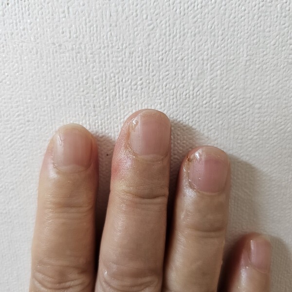 건강의 모든 것