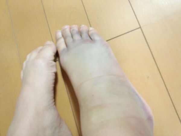 ameblo