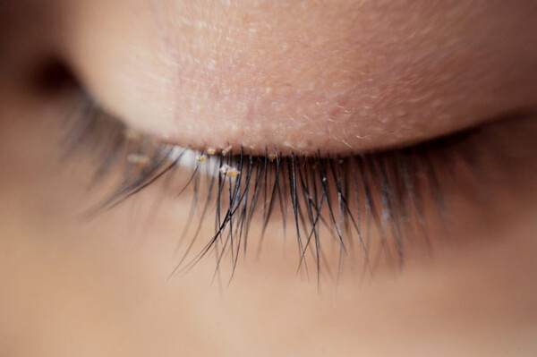scalpd-eye.angfa-store