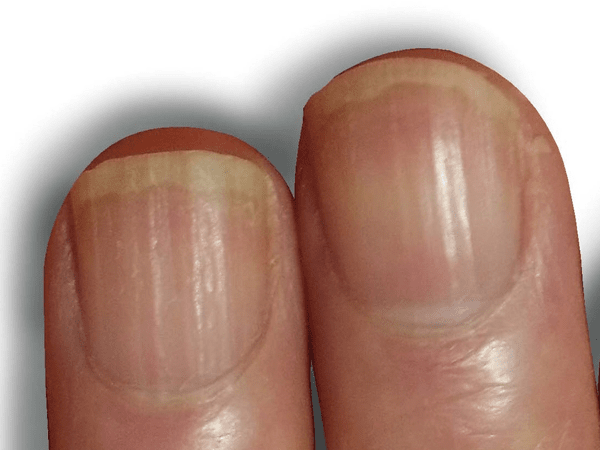 nailclinique