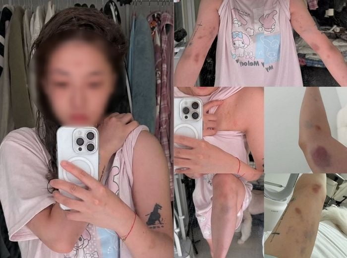 티브이데일리 포토