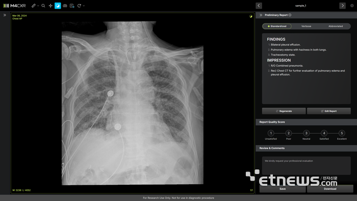 딥노이드 'M4CXR'