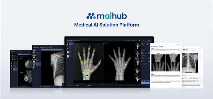 의료 인공지능(AI) 플랫폼 기업 마이허브가 인수한 골연령 분석 솔루션 '마이:본에이지'.(사진=마이허브)
