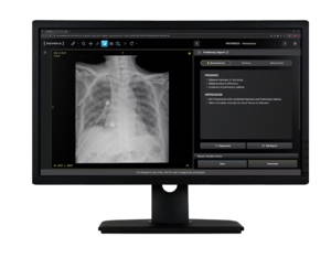 딥노이드 생성형 AI 기반 흉부 엑스레이 판독 솔루션 'M4CXR'(사진=딥노이드)