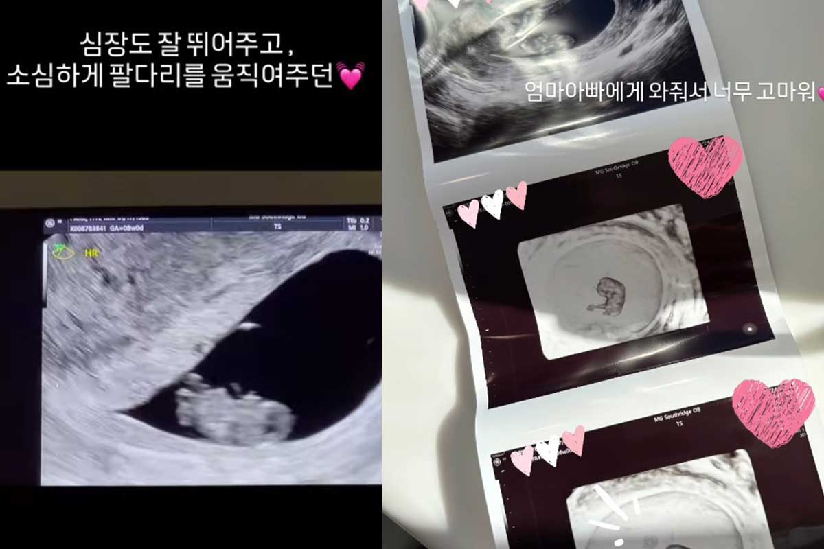 출처 :  혜박 SNS