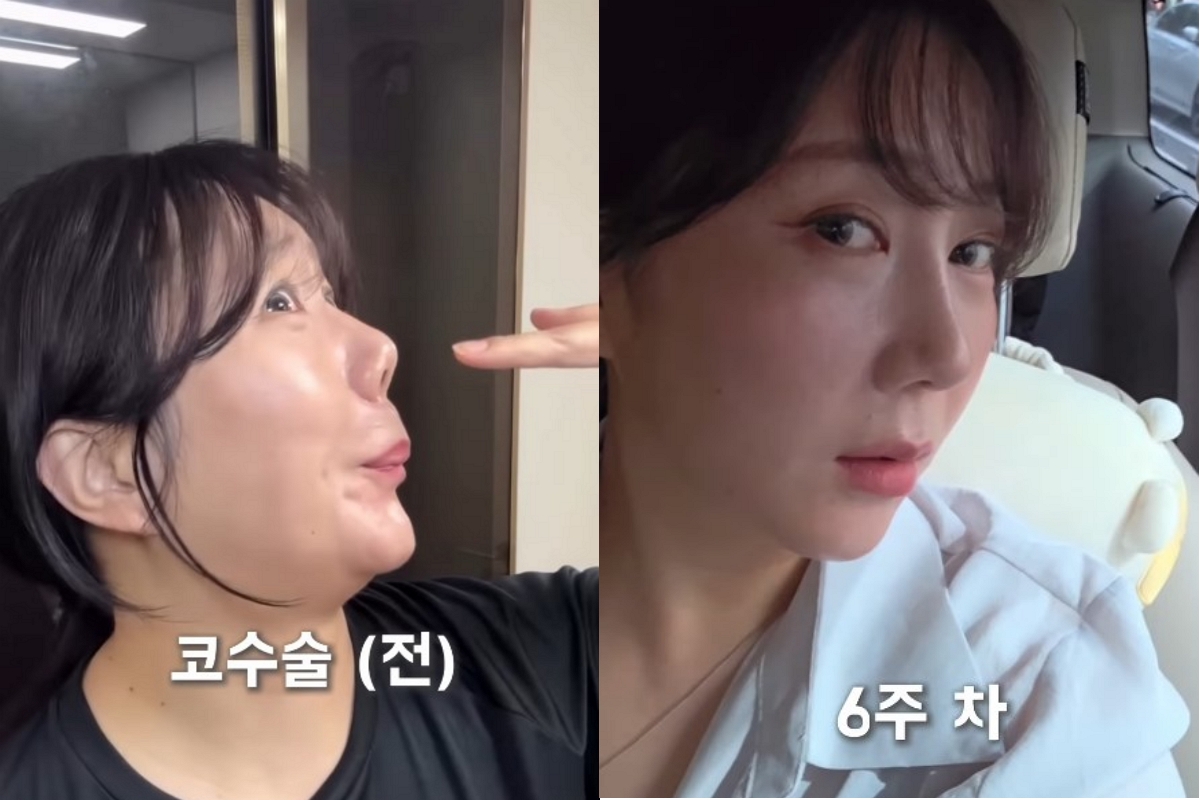 출처: 허안나 SNS