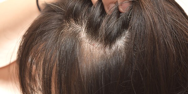 super-scalp
