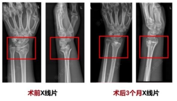 引用：CCTV