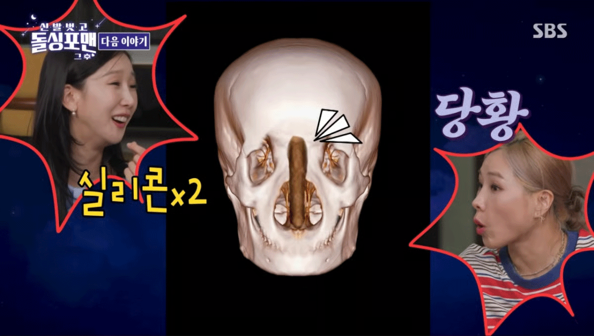 출처 : SBS '신발 벗고 돌싱포맨'