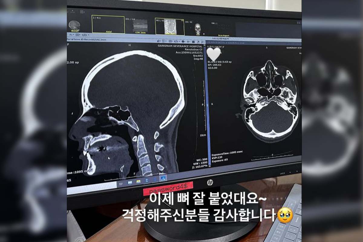 출처: 이현이 SNS