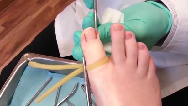cbfootcare