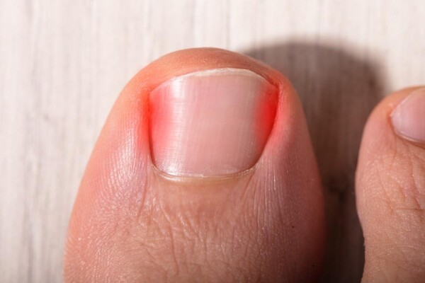 ssfoot