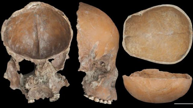 引用:Sawada et al, Scientific Reports