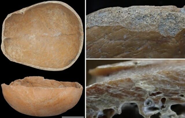 引用:Sawada et al, Scientific Reports