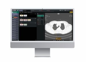 코어라인소프트의 AI 기반 폐질환 검진 솔루션 '에이뷰 2.0'(사진=코어라인소프트)