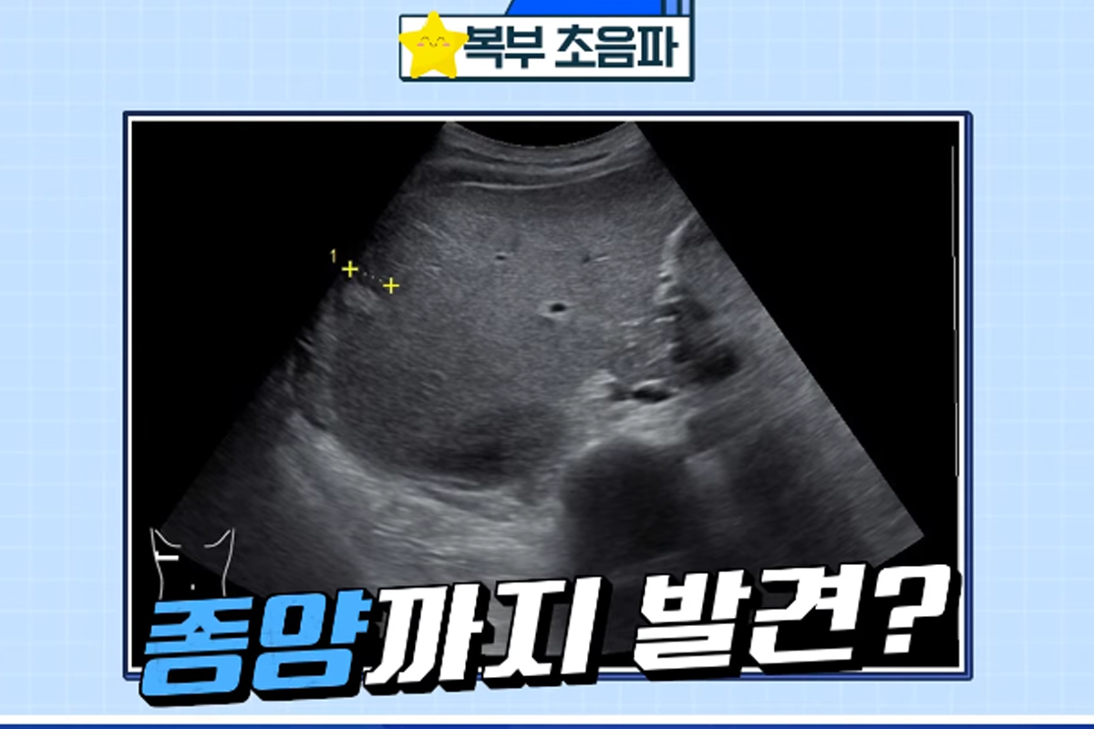 출처 : 채널A '스타건강랭킹 넘버원'