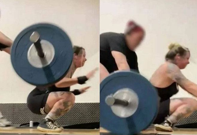 A woman in her thirties suffered a shocking double ankle fracture while attempting a weighted squat at her local gym / Courtesy of Kennedy News and Media