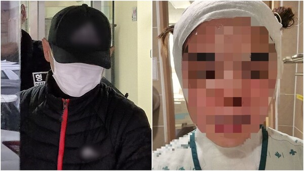 특수상해 혐의로 구속된 40대 남성과 중화상을 입은 태국인 아내. ⓒ뉴스1, 페이스북 갈무리 