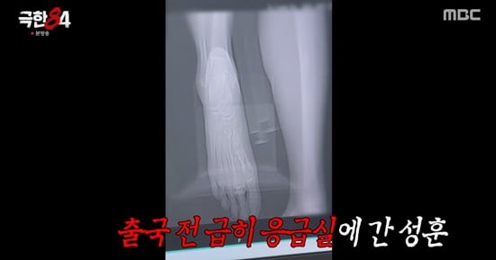 引用:MBC『極限84』