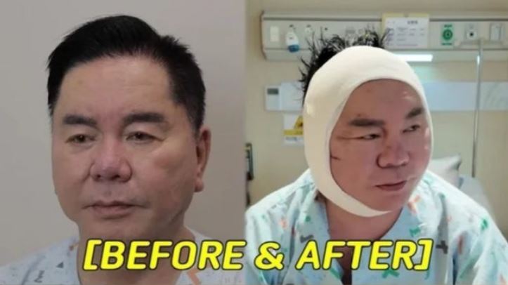 티브이데일리 포토