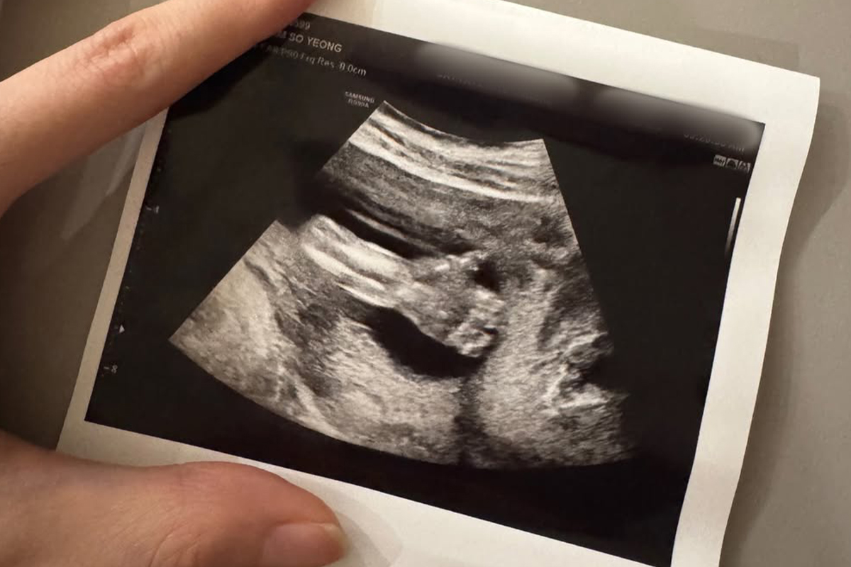 출처 : 김소영 SNS